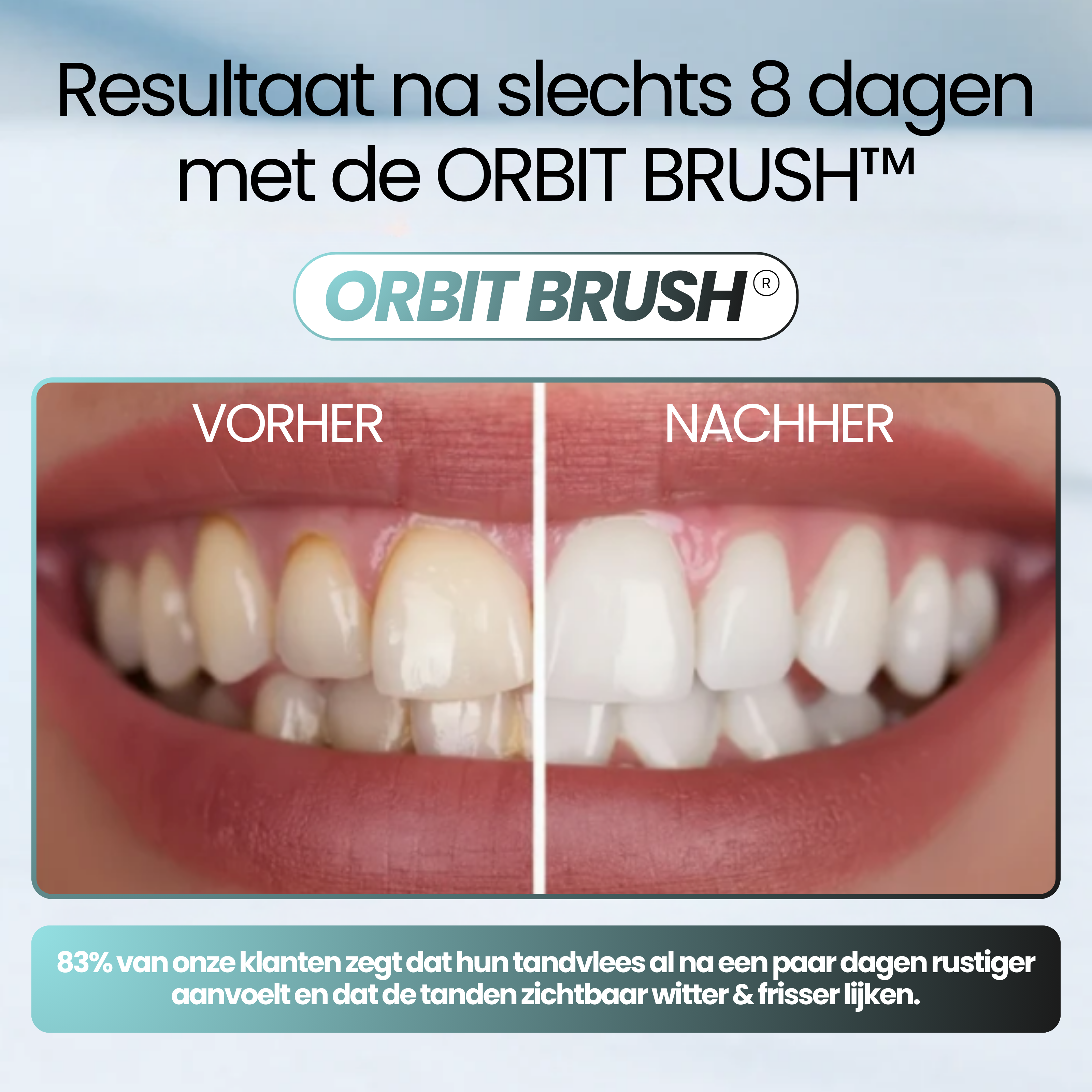 ORBIT BRUSH® - 360° tandenborstel voor schone tanden – ook als je niet perfect poetst.